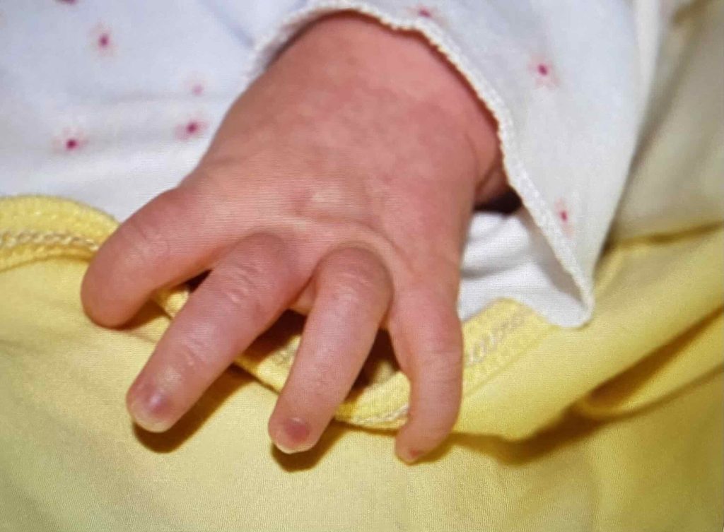 A baby's fingers.