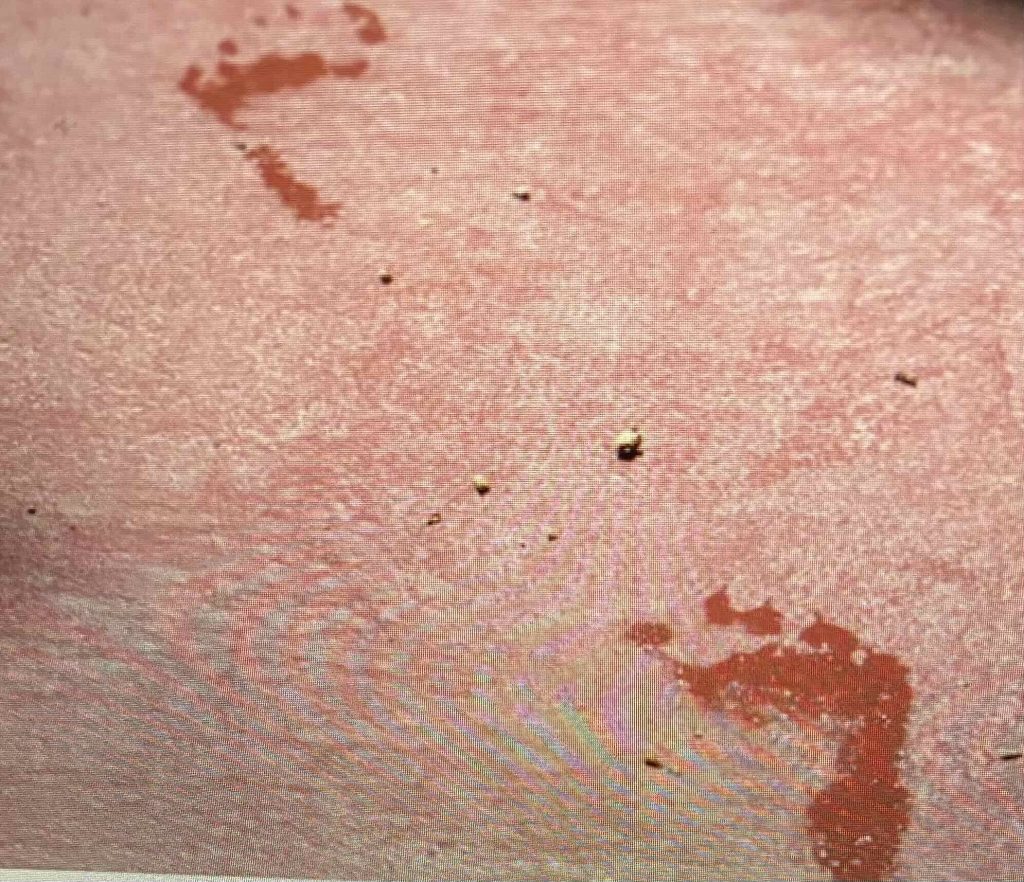 Foot prints.